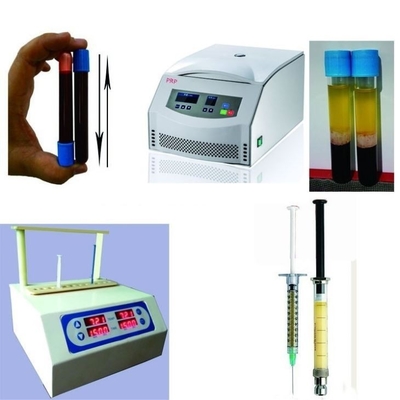 6/8x15ml جهاز طرد مركزي محمول PRP 0-4000rpm لمستشفيات الجراحة التجميلية