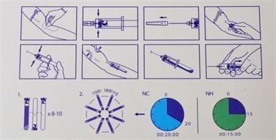 6/8x15ml جهاز طرد مركزي محمول PRP 0-4000rpm لمستشفيات الجراحة التجميلية